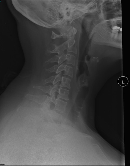 what is the cpt code soft tissue x-ray neck